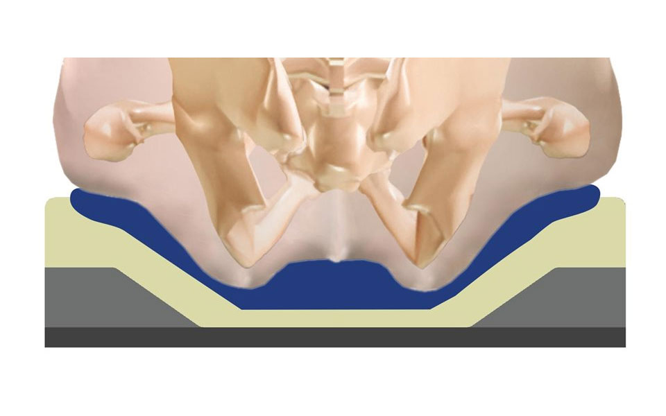 Pelvic Loading Area Determined by Common Skeletal Measurement